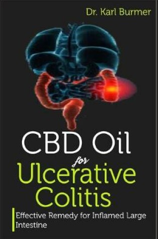 Cover of CBD Oil for Ulcerative Colitis