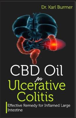 Book cover for CBD Oil for Ulcerative Colitis