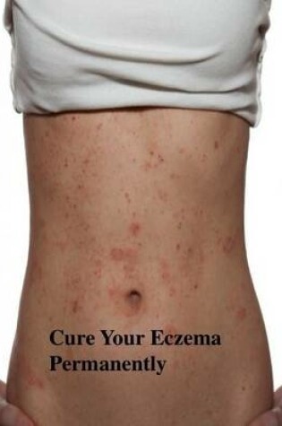 Cover of Cure Your Eczema Permanently