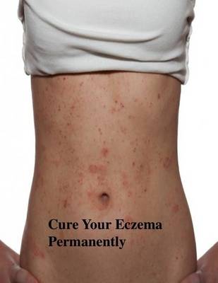 Book cover for Cure Your Eczema Permanently