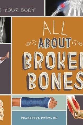 Cover of All about Broken Bones