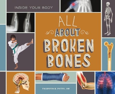 Book cover for All about Broken Bones