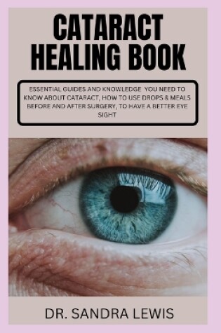 Cover of Cataract Healing Book