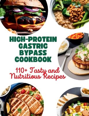 Book cover for High-Protein Gastric Bypass Cookbook