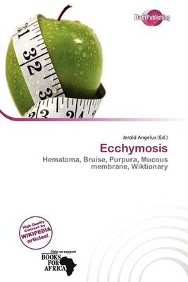 Book cover for Ecchymosis