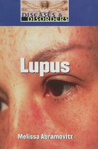 Cover of Lupus