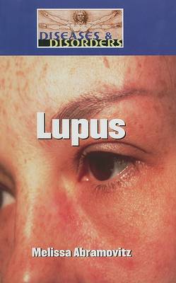 Cover of Lupus