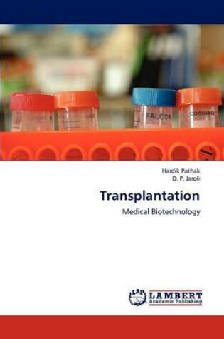 Cover of Transplantation