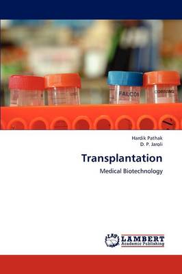 Book cover for Transplantation