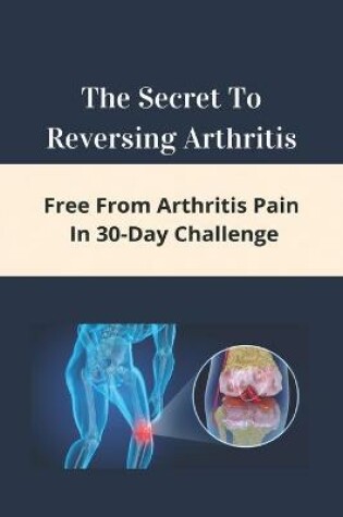 Cover of The Secret To Reversing Arthritis