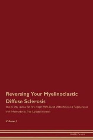 Cover of Reversing Your Myelinoclastic Diffuse Sclerosis