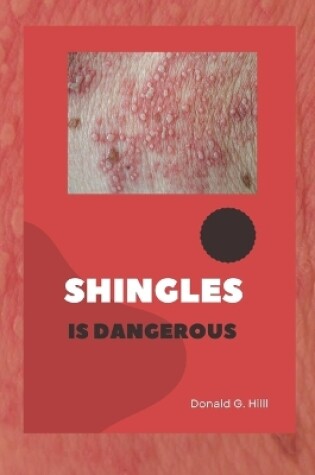 Cover of Shingles