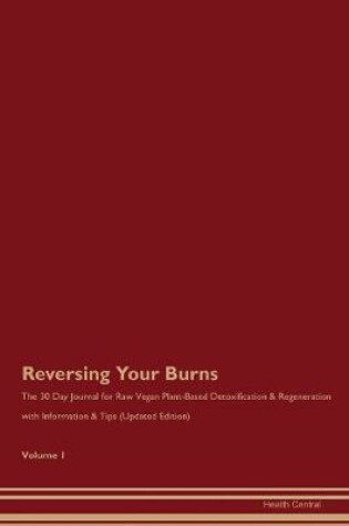 Cover of Reversing Your Burns