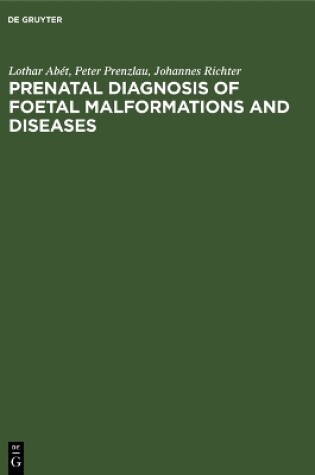 Cover of Prenatal Diagnosis of Foetal Malformations and Diseases