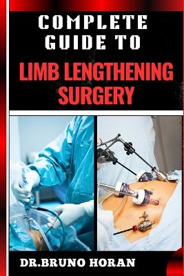 Cover of Complete Guide to Limb Lengthening Surgery