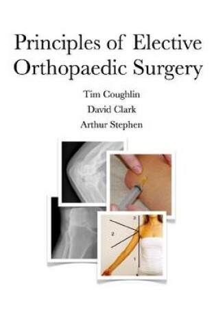Cover of Principles of Elective Orthopaedic Surgery
