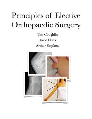 Book cover for Principles of Elective Orthopaedic Surgery