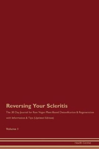 Cover of Reversing Your Scleritis