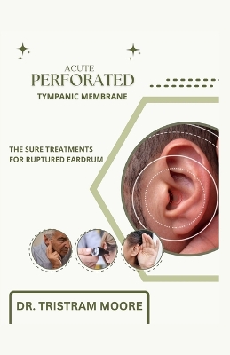 Cover of Acute Perforated Tympanic Membrane