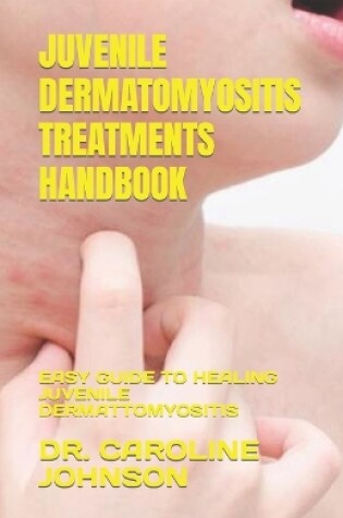 Cover of Juvenile Dermatomyositis Treatments Handbook
