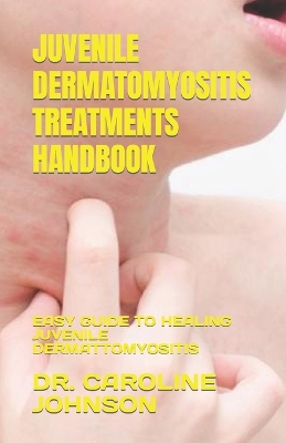 Book cover for Juvenile Dermatomyositis Treatments Handbook