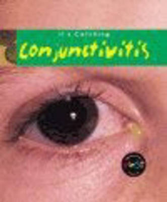 Cover of It's Catching: Conjunctivitis