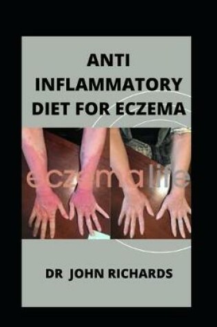 Cover of Anti Inflammatory Diet For Eczema