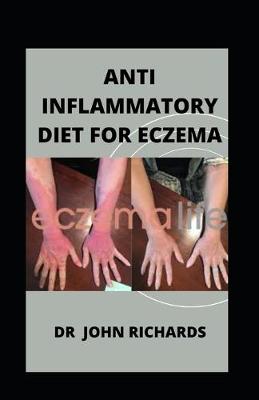 Book cover for Anti Inflammatory Diet For Eczema