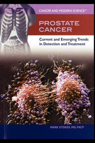 Cover of Prostate Cancer