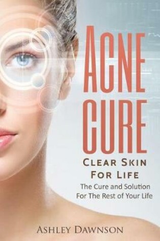 Cover of Acne Cure Clear Skin For Life