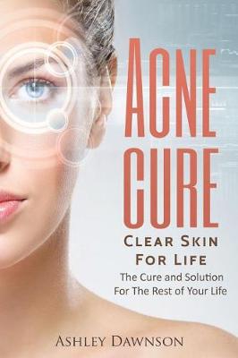 Book cover for Acne Cure Clear Skin For Life