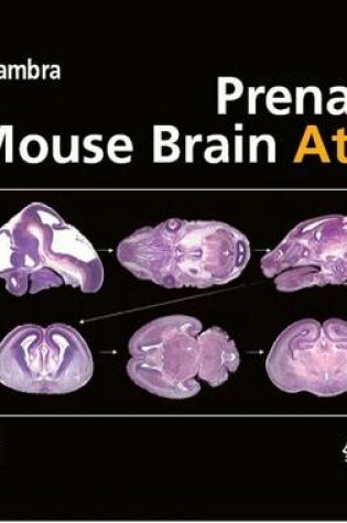 Cover of Prenatal Mouse Brain Atlas