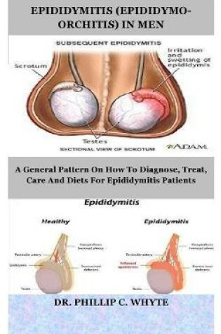 Cover of Epididymitis (Epididymo-Orchitis) in Men