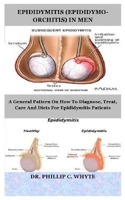 Book cover for Epididymitis (Epididymo-Orchitis) in Men