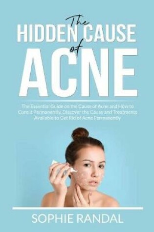 Cover of The Hidden Cause of Acne