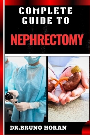 Cover of Complete Guide to Nephrectomy