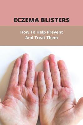 Cover of Eczema Blisters