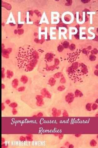 Cover of All about Herpes