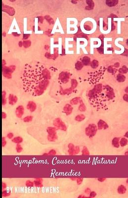 Book cover for All about Herpes