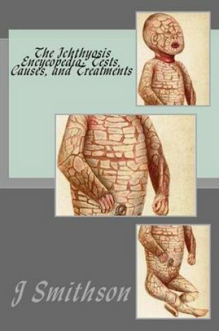 Cover of The Ichthyosis Encycopedia