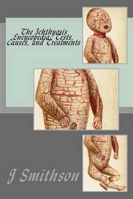 Cover of The Ichthyosis Encycopedia