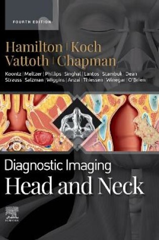 Cover of Head and Neck - E-Book