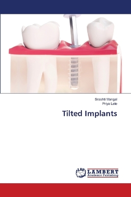 Book cover for Tilted Implants