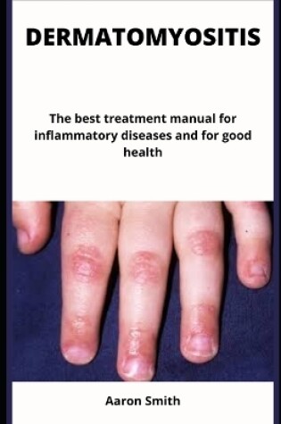 Cover of Dermatomyositis