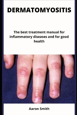 Book cover for Dermatomyositis
