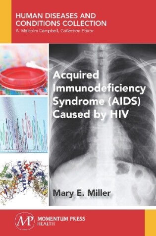 Cover of Acquired Immunodeficiency Syndrome (AIDS) Caused by HIV