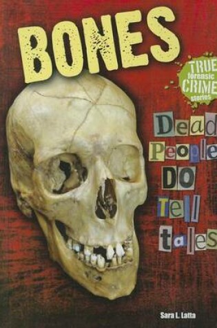 Cover of Bones