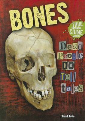 Cover of Bones