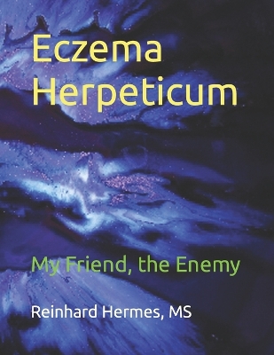 Book cover for Eczema Herpeticum