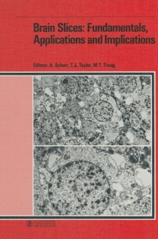 Cover of Brain Slices: Fundamentals, Applications and Implications